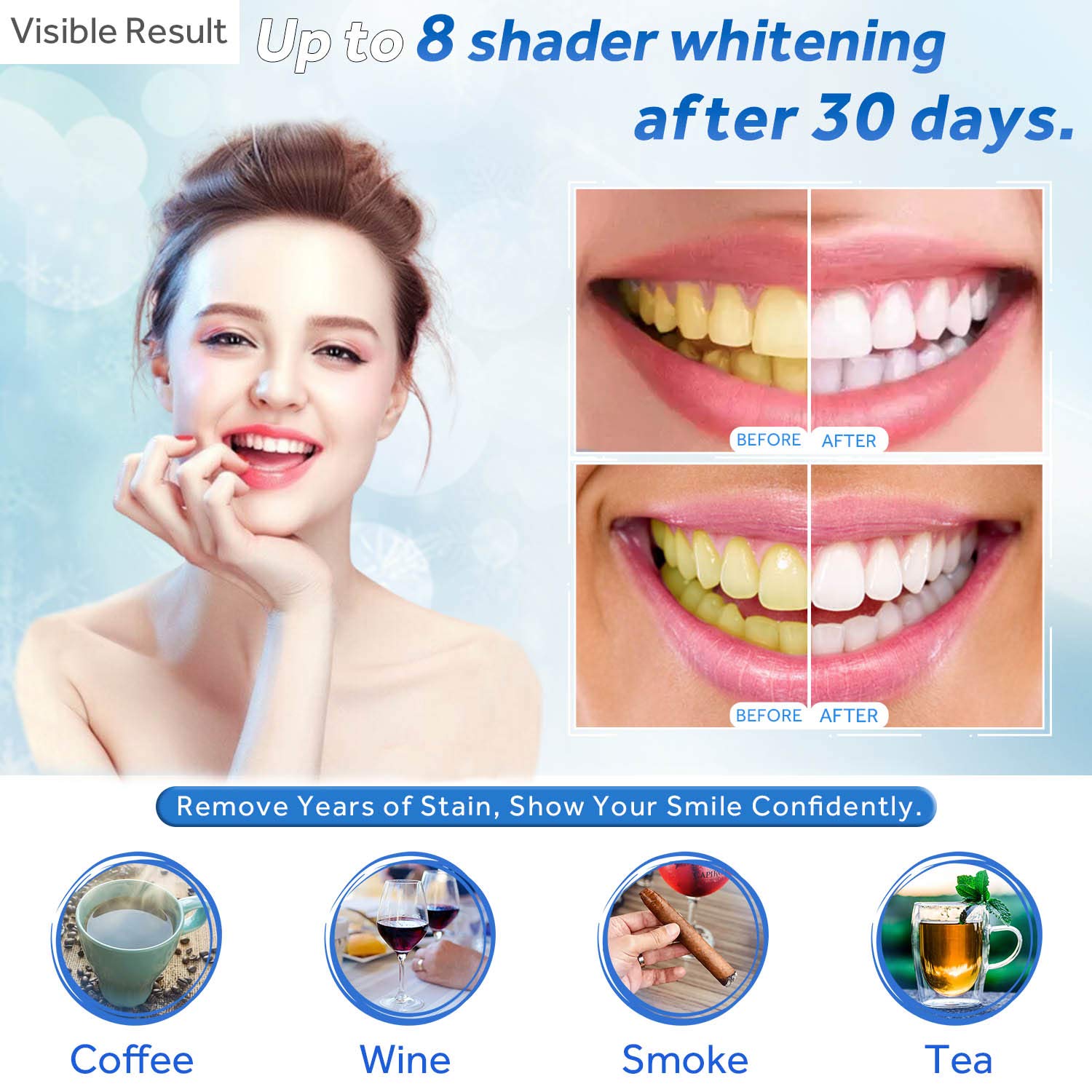 Gel sbiancante per denti Ricar - Teeth Whitening Opalescence recensione e prezzo