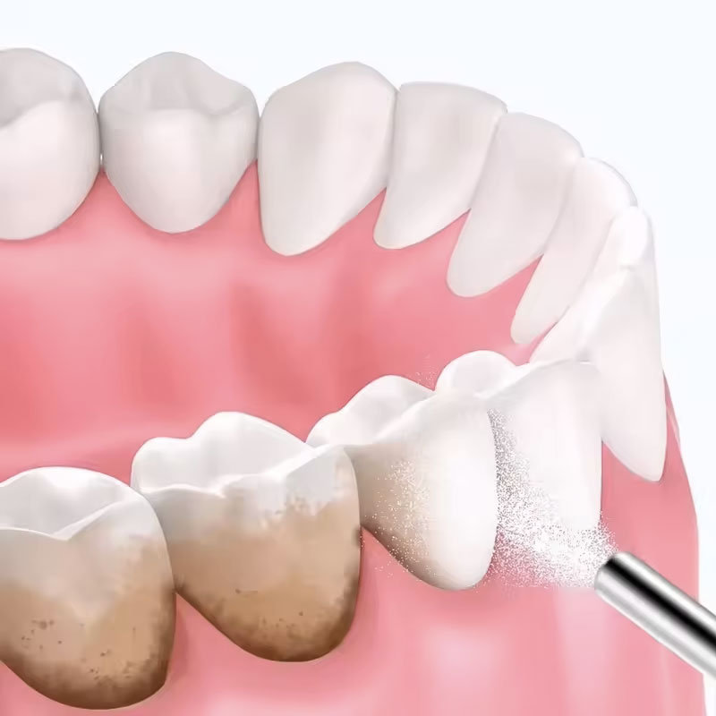 Polvere per Sabbiatura Dentale - Teeth Whitening Ingredients recensione e prezzo